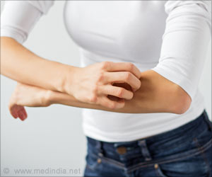 Study Shows How Brain Senses an Itch Study Shows How Brain Senses an Itch