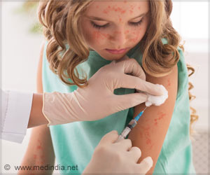 Key Areas of Measles Virus Polymerase to Target for Antiviral Drug Development Discovered Key Areas of Measles Virus Polymerase to Target for Antiviral Drug Development Discovered