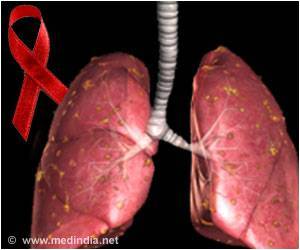 New Vaccine Can Target Tuberculosis New Vaccine Can Target Tuberculosis