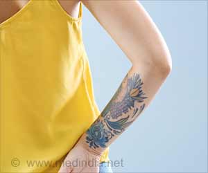 Tattooing May Lead To Transfer Of Metal Particles From The Needles Into The Body Tattooing May Lead To Transfer Of Metal Particles From The Needles Into The Body