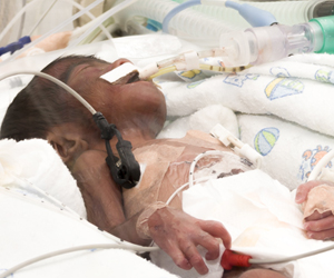 Stable Home Lives Improve Prospects for Preemies: Study Stable Home Lives Improve Prospects for Preemies: Study
