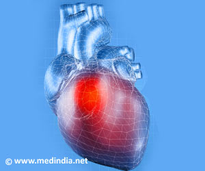 Promising Approach to Reducing Plaque in Arteries Discovered Promising Approach to Reducing Plaque in Arteries Discovered