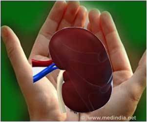 Many Kidneys Discarded in the United States Would be Transplanted in France: Study Many Kidneys Discarded in the United States Would be Transplanted in France: Study