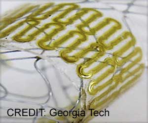 New Stretchable Wireless Sensor Could Track Healing of Cerebral Aneurysms New Stretchable Wireless Sensor Could Track Healing of Cerebral Aneurysms