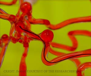 Robotic Thread Crawls Through the Brain to Treat Stroke Robotic Thread Crawls Through the Brain to Treat Stroke