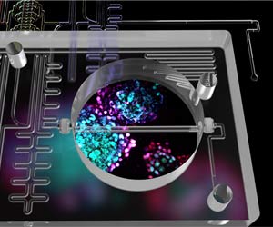 Pancreas-on-a-Chip Developed Using 2 Powerful Technologies Pancreas-on-a-Chip Developed Using 2 Powerful Technologies