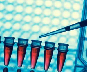 New Biomarker for Rare Autoimmune Disease Discovered New Biomarker for Rare Autoimmune Disease Discovered