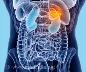 Family Perceptions of End-of-life Care for Patients With Advanced Kidney Disease, Says Study Family Perceptions of End-of-life Care for Patients With Advanced Kidney Disease, Says Study