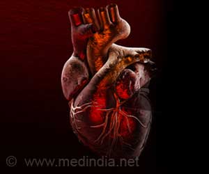 Screening for Genetic High Cholesterol Could Help Avoid Heart Attack Screening for Genetic High Cholesterol Could Help Avoid Heart Attack