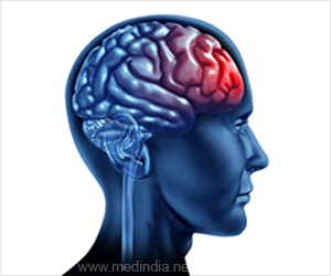 Single Brain Injury Linked to Neurodegeneration Single Brain Injury Linked to Neurodegeneration
