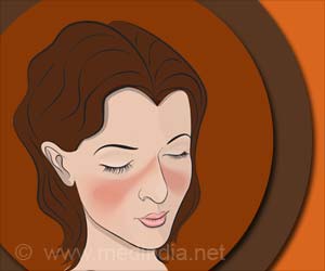 WHO Autoantibody Reference Reagent Benefits Lupus Patients WHO Autoantibody Reference Reagent Benefits Lupus Patients