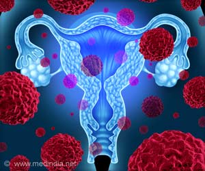Link Between PTSD and Ovarian Cancer Discovered Link Between PTSD and Ovarian Cancer Discovered