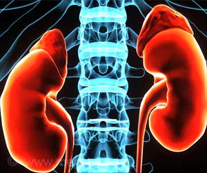 Kidney Diseases Can Now Easily Diagnosed Using Artificial Intelligence Kidney Diseases Can Now Easily Diagnosed Using Artificial Intelligence