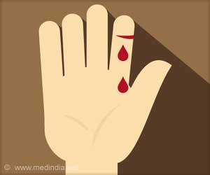 Cross Talk Between Blood-clotting Disorders Discovered Cross Talk Between Blood-clotting Disorders Discovered