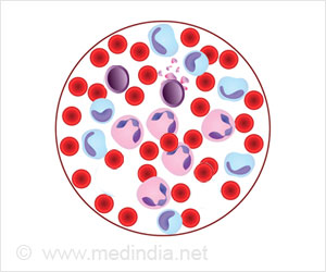 Antihistamines Potential to Kill Leukemic Stem Cells Discovered Antihistamines Potential to Kill Leukemic Stem Cells Discovered