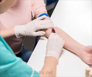 New Blood Test Could Help Early Detection of Pancreatic Cancer New Blood Test Could Help Early Detection of Pancreatic Cancer