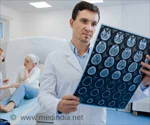 Brain Changes may Help Track Early Signs of Dementia, Even Before Diagnosis Brain Changes may Help Track Early Signs of Dementia, Even Before Diagnosis