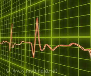 Electrical-first Cardioversion Approach for AFib Results in Shorter ED Length of Stay Electrical-first Cardioversion Approach for AFib Results in Shorter ED Length of Stay