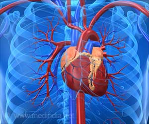 Biomarker for POTS, a Debilitating Fainting Condition Discovered Biomarker for POTS, a Debilitating Fainting Condition Discovered