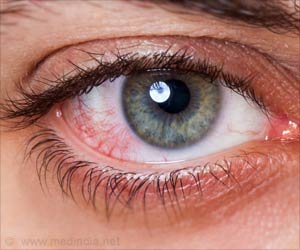 Two Routine Drugs Show Similarity In Treating Uveitis Two Routine Drugs Show Similarity In Treating Uveitis