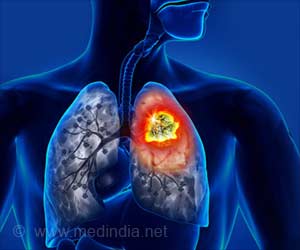 Nivolumab Shows More Survival Rate Compared to Chemotherapy Nivolumab Shows More Survival Rate Compared to Chemotherapy