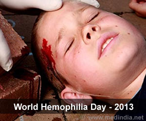 Hemophilia Is Three Times More Common Hemophilia Is Three Times More Common