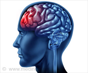 Innovative Treatment Prevent Common Brain Infection: Study Innovative Treatment Prevent Common Brain Infection: Study