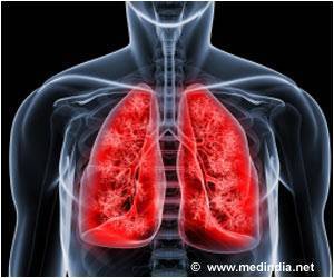 Study Finds Novel Drug Target For Pulmonary Arterial Hypertension Study Finds Novel Drug Target For Pulmonary Arterial Hypertension