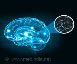 Study reveals Origin & New Way to Find Drugs For Huntington's Study reveals Origin & New Way to Find Drugs For Huntington's