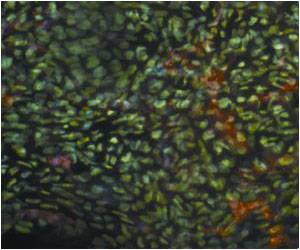 New Microchip to Track Stem Cells Movement Discovered New Microchip to Track Stem Cells Movement Discovered