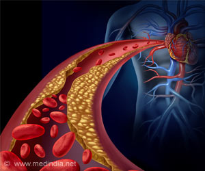 Familial Hypercholesterolemia Patients are More Prone to Heart Disease Familial Hypercholesterolemia Patients are More Prone to Heart Disease