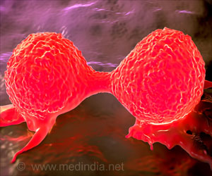 Survival in Women, Men Diagnosed With Breast Cancer: Study Survival in Women, Men Diagnosed With Breast Cancer: Study