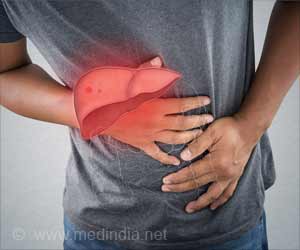 Toxic Algae Exposure may Pose Greater Risk to People with Pre-existing Liver Conditions Toxic Algae Exposure may Pose Greater Risk to People with Pre-existing Liver Conditions
