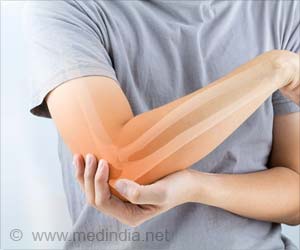 New Protein Slows Down Fracture Healing New Protein Slows Down Fracture Healing