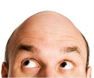 Electric Technology can Help Reverse Baldness Electric Technology can Help Reverse Baldness