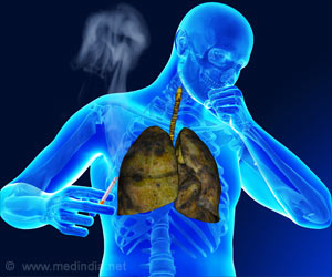 Over 21.5 Lakh Tuberculosis Cases Reported in 2018 in India Over 21.5 Lakh Tuberculosis Cases Reported in 2018 in India