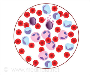 New CAR T Cells Help Avoid Cancer Relapse New CAR T Cells Help Avoid Cancer Relapse