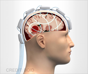 Maturing From Child To Adolescent May Change Brain's Anatomy Maturing From Child To Adolescent May Change Brain's Anatomy