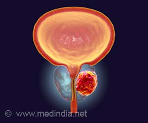 Long Term Hormone Therapy Ups Mortality Risk for Men With Low PSA Long Term Hormone Therapy Ups Mortality Risk for Men With Low PSA