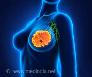 Inhibitors That Improve Overall Survival in Advanced Breast Cancer Discovered Inhibitors That Improve Overall Survival in Advanced Breast Cancer Discovered