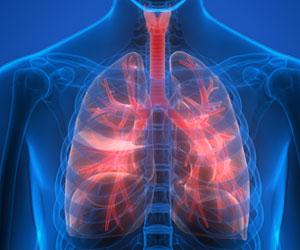 Nintedanib Slows Progression of Scarring Lung Diseases: Study Nintedanib Slows Progression of Scarring Lung Diseases: Study