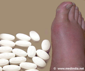 Heart, Kidney Diseases Raise the Risk of Side Effects of Gout Drug Heart, Kidney Diseases Raise the Risk of Side Effects of Gout Drug