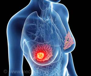 Critical Process for How Breast Cancer Spreads in Bones Discovered Critical Process for How Breast Cancer Spreads in Bones Discovered