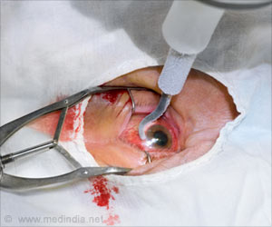 Cataract Surgery Linked to Driving Performance Cataract Surgery Linked to Driving Performance