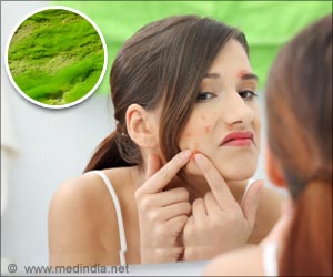 Acne Related to Regular Consumption of Sweets, Cakes and Junk Foods Acne Related to Regular Consumption of Sweets, Cakes and Junk Foods