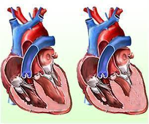Drug Reduces Inflammation in Genetic Heart Disease