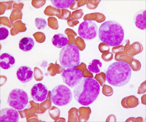 New Antibody That Eradicates Leukemia Stem Cells Discovered New Antibody That Eradicates Leukemia Stem Cells Discovered