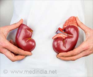Kidney Replacement Therapy Rates Have Remained Higher in Men Vs. Women for Decades: Study Kidney Replacement Therapy Rates Have Remained Higher in Men Vs. Women for Decades: Study