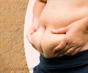 Soft Drinks: A Crucial Link Between Obesity and Tooth Wear Soft Drinks: A Crucial Link Between Obesity and Tooth Wear