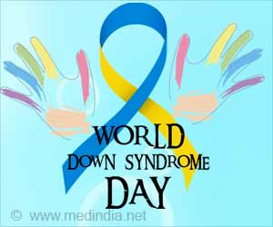 Down Syndrome Linked to Dementia Down Syndrome Linked to Dementia